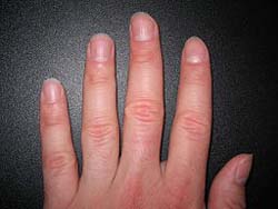 Healthy Fingernails Healthy Fingernails