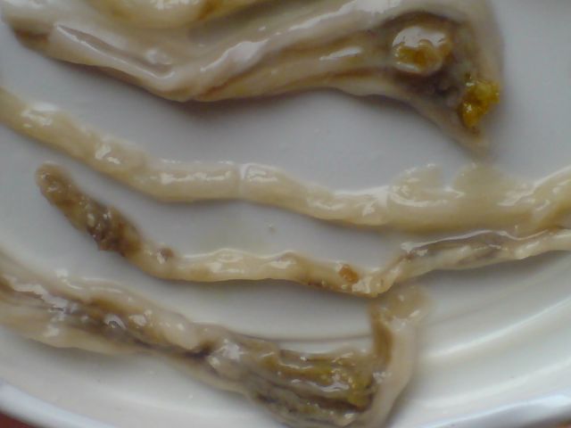 candidiasis